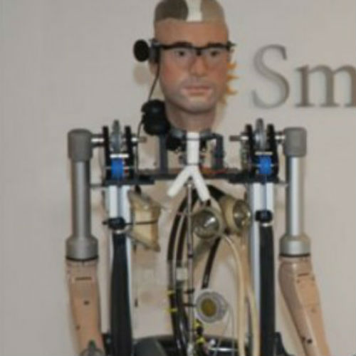 Создан первый в мире бионический человек